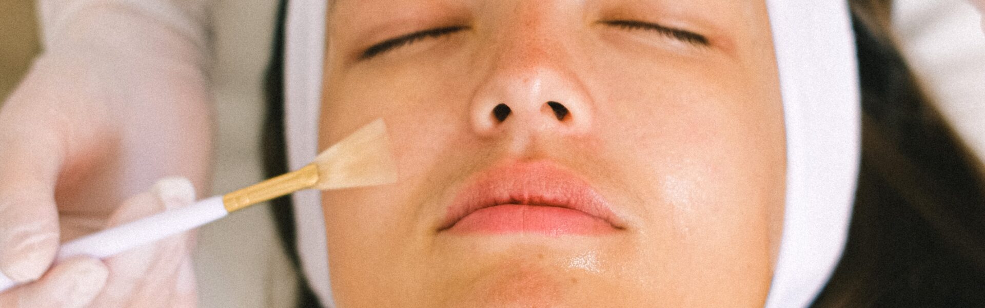 New year, new face – benefits of getting a chemical peel!￼ banner