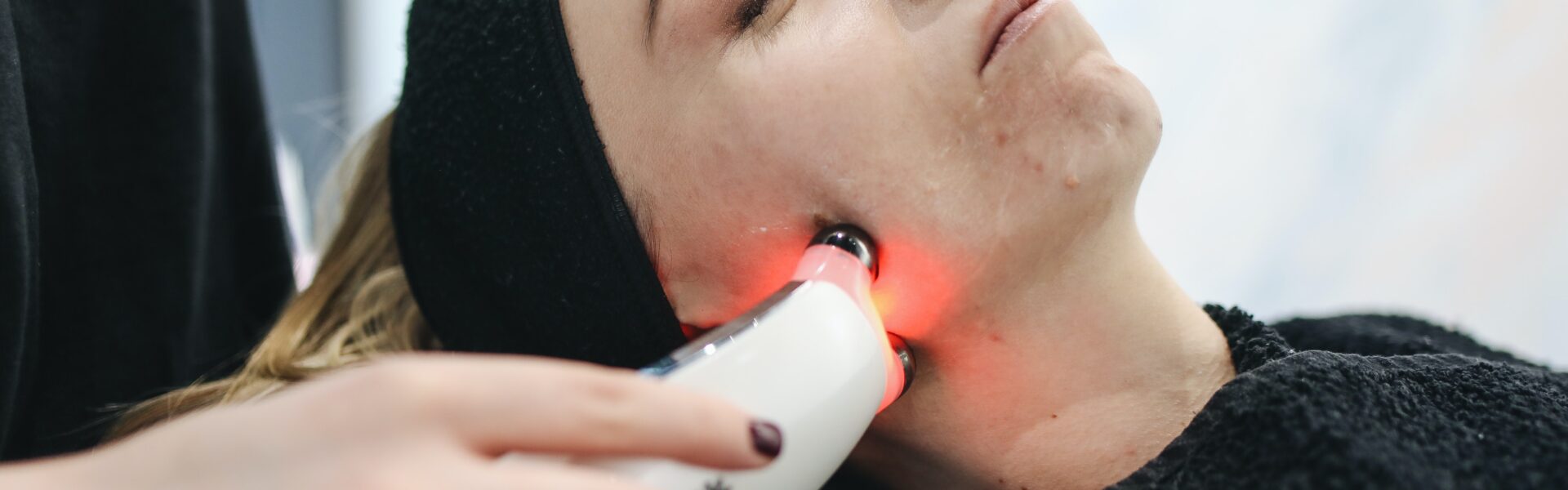 What do I need to know about laser resurfacing for better skin? banner