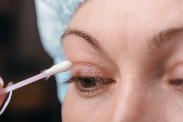 The Connection Between Eyelids and Vision: When to Consider Functional Eyelid Surgery featured image