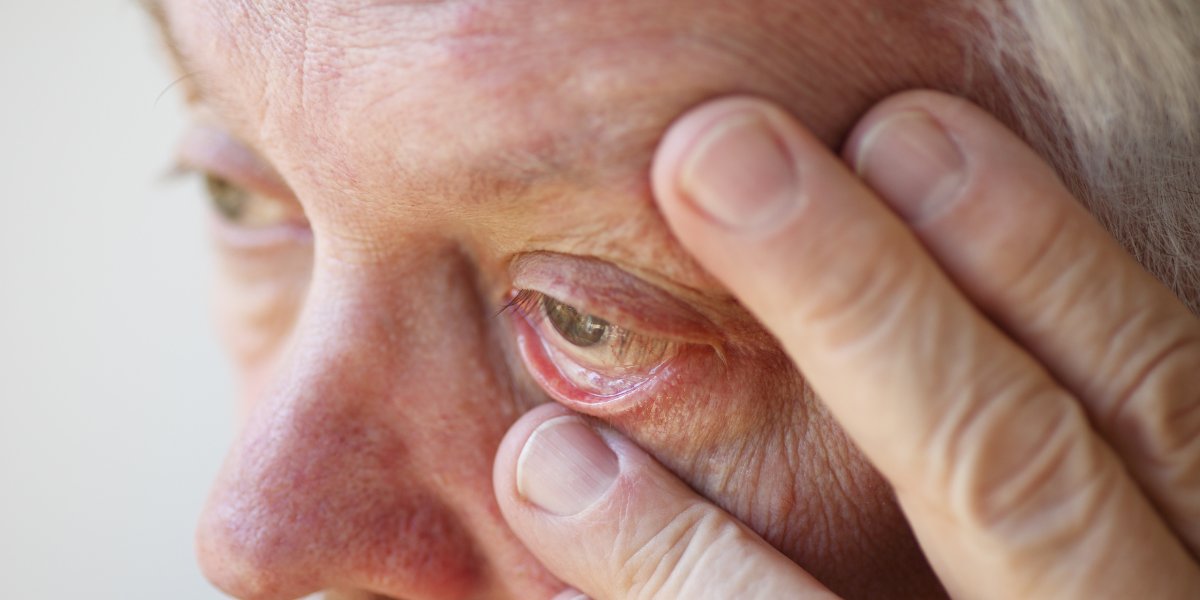 Understanding eyelid conditions: Causes, symptoms, and treatment options banner