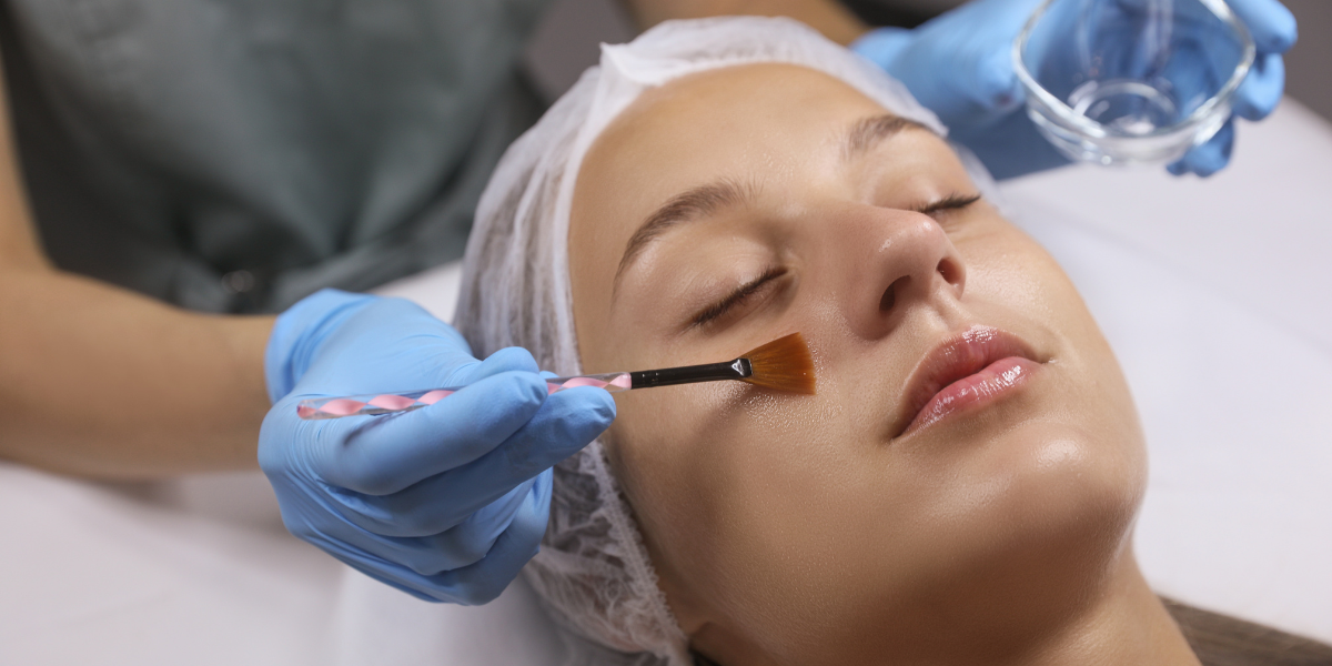 Unveiling the Glow: The Transformative Power of Chemical Peels banner