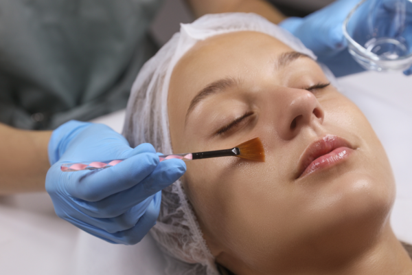 Unveiling the Glow: The Transformative Power of Chemical Peels featured image