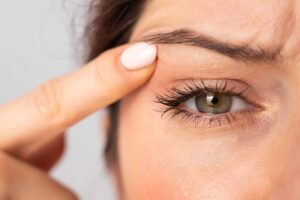 What is the Difference Between Ptosis and Blepharoplasty featured image