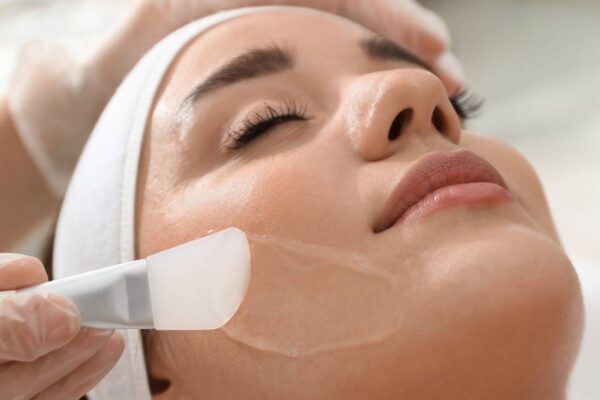 Is May a Good Time for a Chemical Peel? featured image