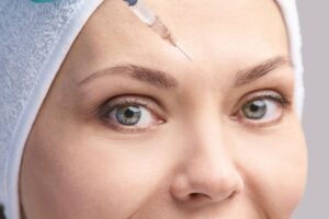 Maximize Summer Botox Treatments featured image