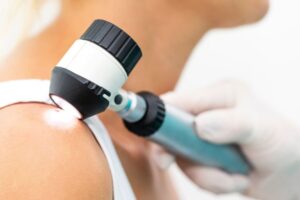 Summer is Over – Time to Revisit Skin Cancer Screenings featured image