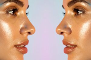 Eyelid & Facial Trends for 2026 featured image