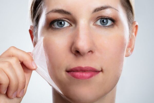 Peel Back Your Winter Skin with a Chemical Peel featured image