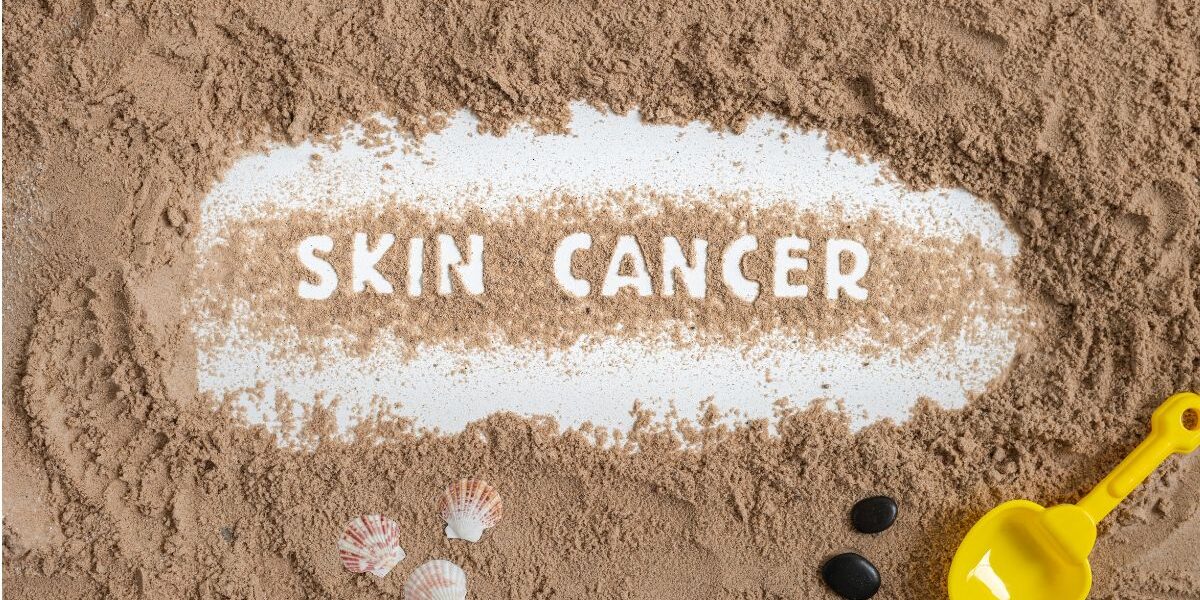 Skin Cancer Awareness – Learn Your ABCDEs of Skin Cancer banner