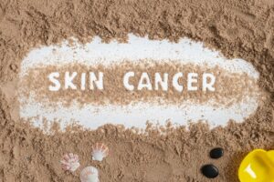 Skin Cancer Awareness – Learn Your ABCDEs of Skin Cancer featured image